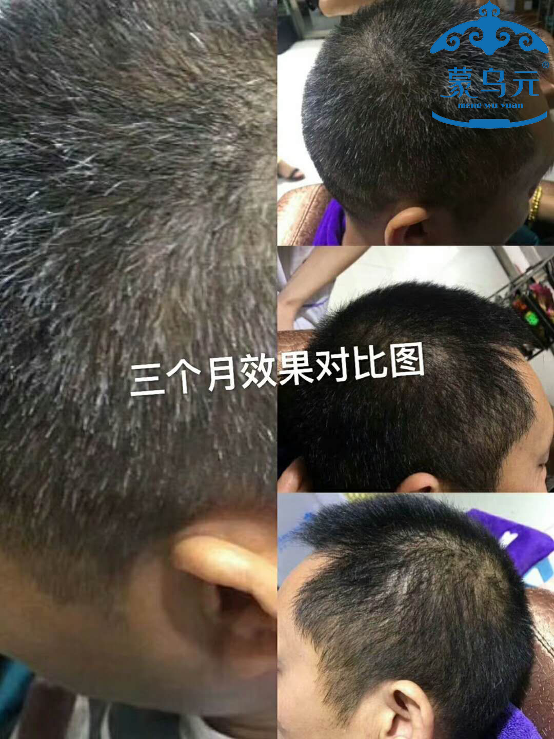 黑发转白发