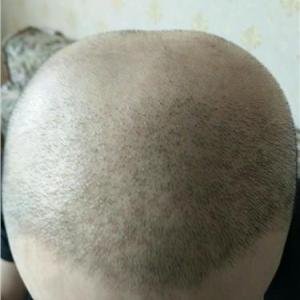 廈門紋發(fā)電話|廈門紋發(fā)咨詢電話 啟點(diǎn)供