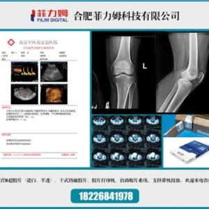 供應合肥國產膠片報價菲力姆供