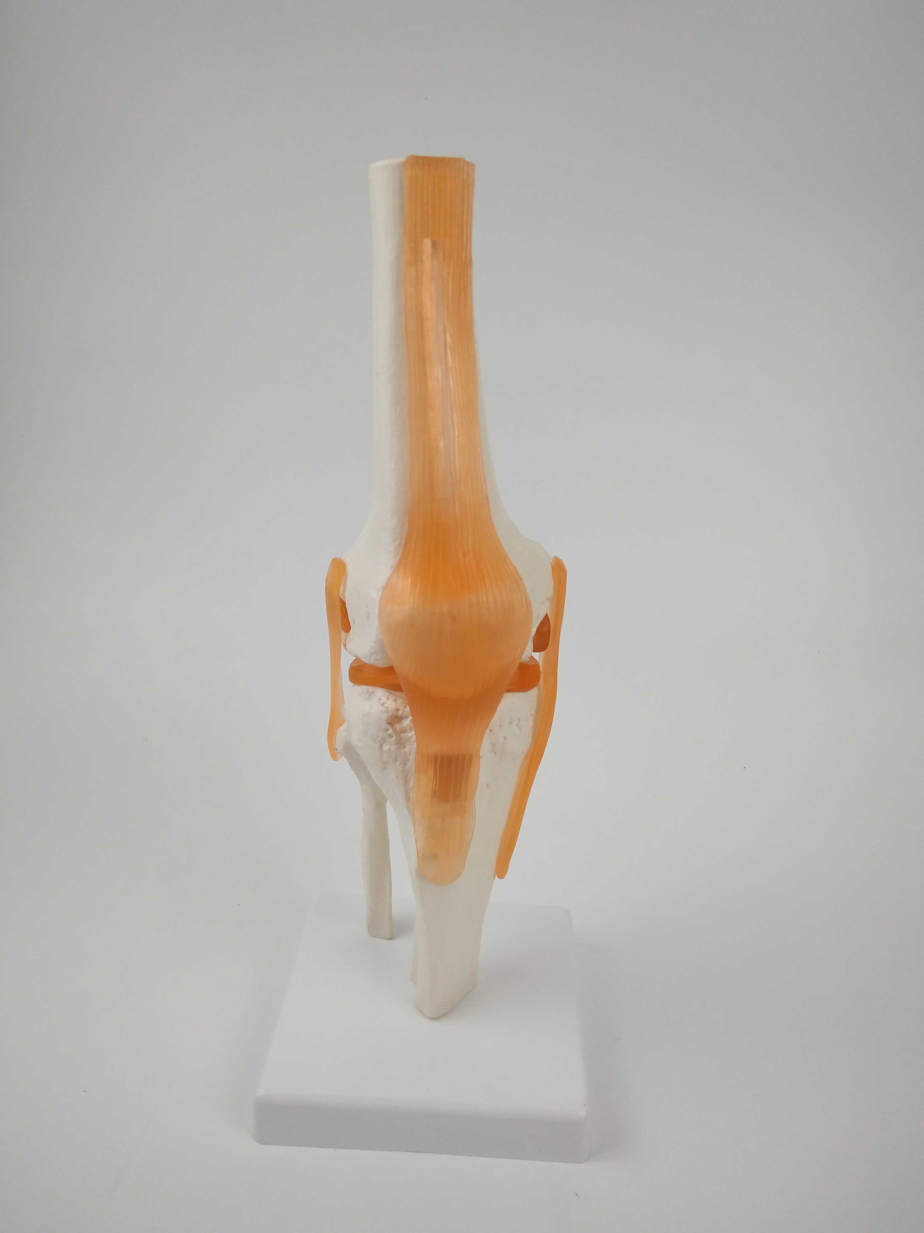 伸展和向内,向外旋转,含部分股骨,胫骨和部分腓骨及膝盖骨,带回头肌腱